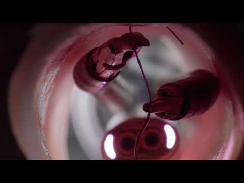 Aperçu de la vidéo : Robotique médicale